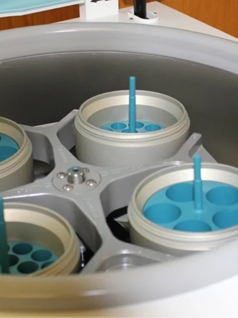 Open centrifuge rotor with sample buckets loaded before a centrifuge calibration check